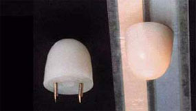 CK842 - 12V Small Pin-I Ceiling Globe